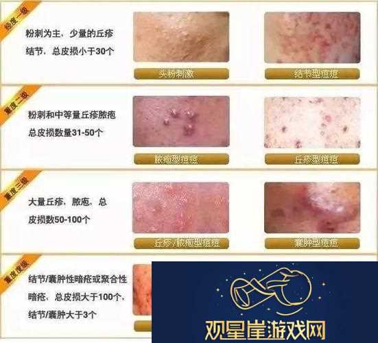女性三角毛毛区长了个硬疙瘩-网友|这是什么情况